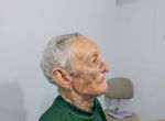 Setor de Odontologia do HCanMT confecciona prótese de nariz para paciente